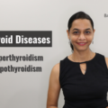 THYROID & ITS DISORDERS | FUNDAMENTALS OF THYROID DISEASES